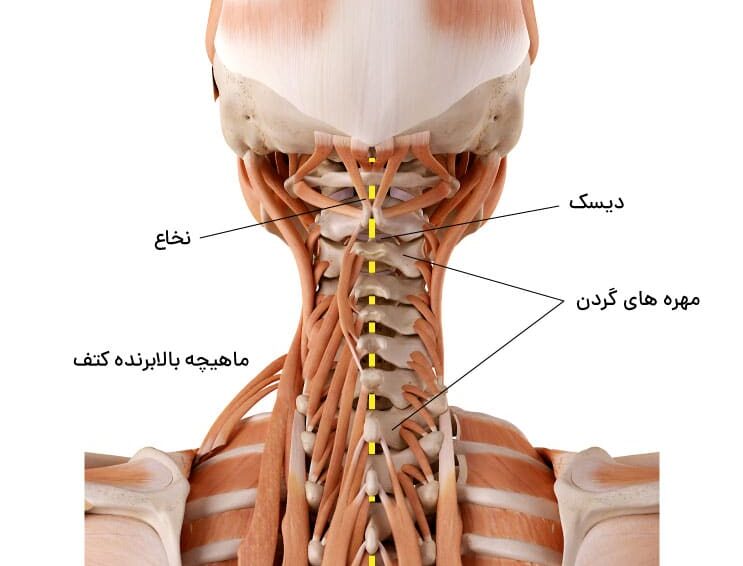 آرتروز گردن چیست